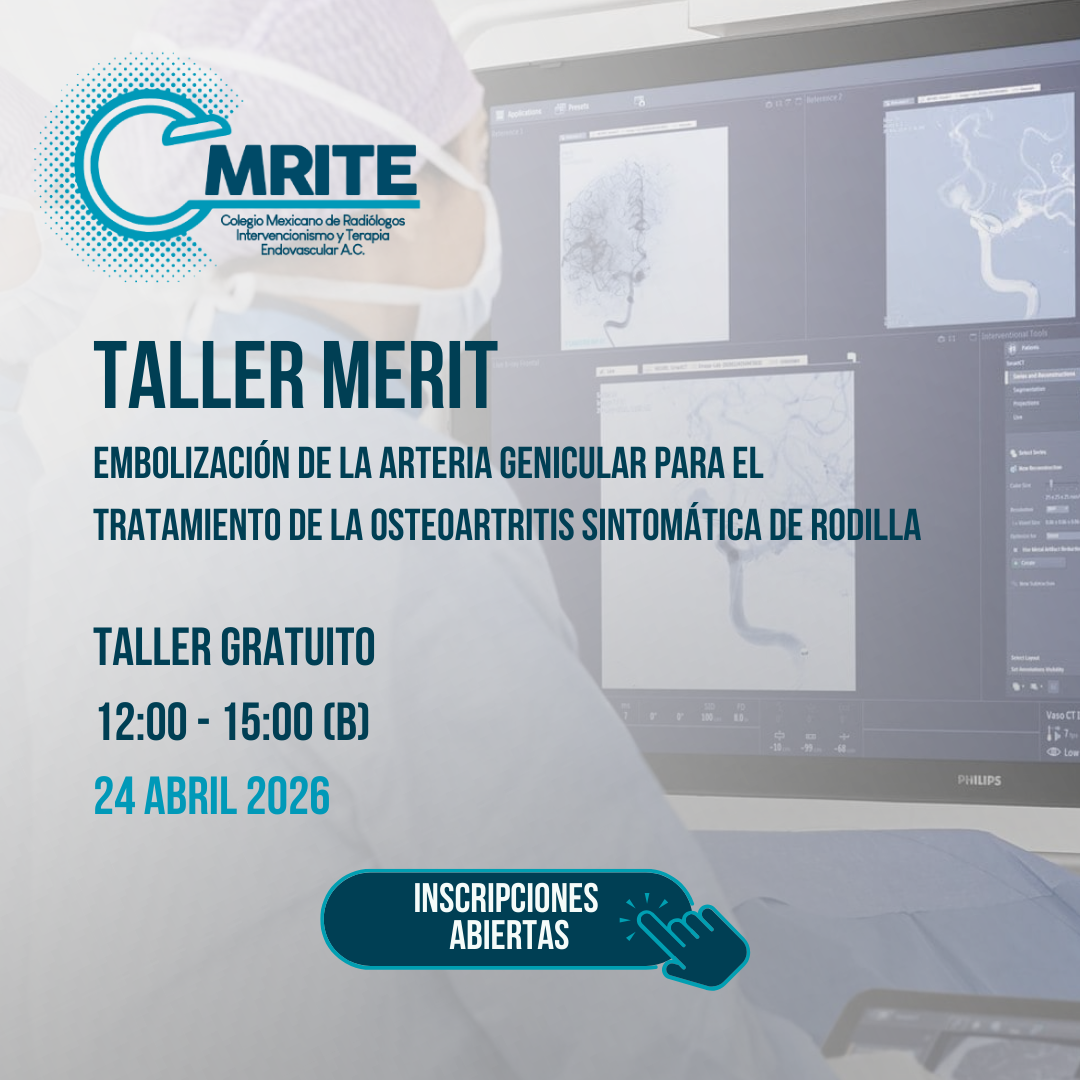 TALLER MERIT: EMBOLIZACIÓN DE LA ARTERIA GENICULAR PARA EL TRATAMIENTO DE LA OSTEOARTRITIS SINTOMÁTICA DE RODILLA